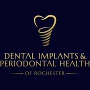 Dental Implants & Periodontal Health