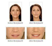Top Facial Plastic Surgeon in Los Angeles