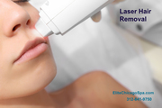 Laser Hair Removal For Men in Chicago