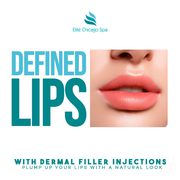 Lip Fillers Chicago - Deals in Chicago,  IL l Elite Spa