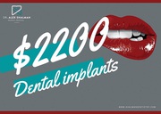 Shalman Dentistry provides dental implants