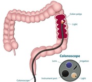 Best Colonoscopy Specialists in NYC