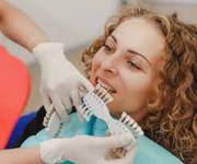 Teeth Whitening In Maryland