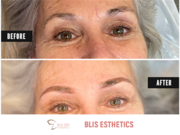 Esthetics Salons near me | Blis Esthetics