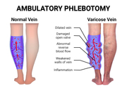 Ambulatory Phlebotomy Bronx NY